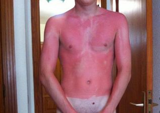 Let this serve as a warning to those of you not using sun factor