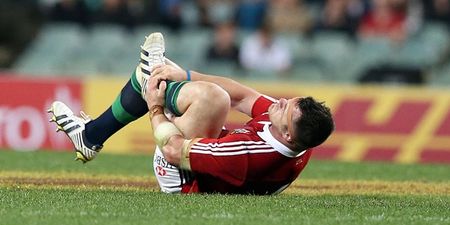 Lions Pic of the Day: Here is the current state of Cian Healy’s ankle