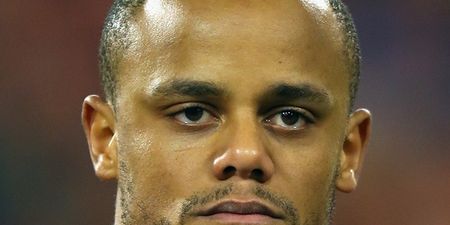 Pic: Vincent Kompany’s face was in a bad way after Belgium’s win over Serbia last night