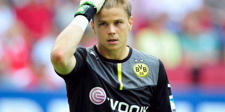 Pic: Dortmund’s keeper wrecked his two front teeth trying to stop Napoli’s brilliant goal last night