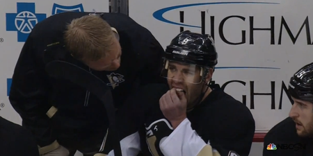 Video: NHL player pulls out two of his own teeth on the bench