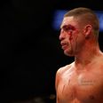 Pic: The gruesome eyecut suffered by Diego Sanchez at UFC 166 (graphic content)