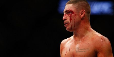 Pic: The gruesome eyecut suffered by Diego Sanchez at UFC 166 (graphic content)