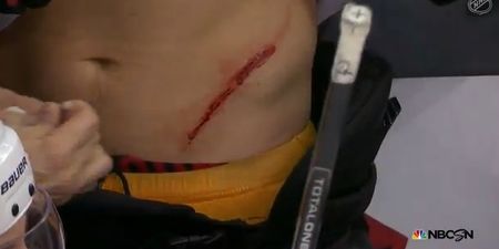 Video: That’s hockey, folks! Player gets torso slashed by skate, plays on, scores winner
