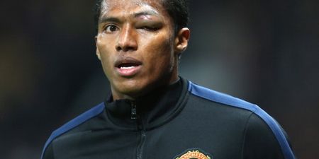 Pic: Antonio Valencia’s eye was in some state after the Man United game last night