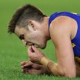 Video: Aussie Rules player loses his two front teeth during an AFL game