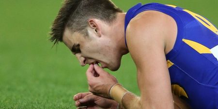 Video: Aussie Rules player loses his two front teeth during an AFL game