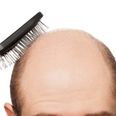 Hair Today Gone Tomorrow: JOE takes a look at receding hairlines and how LLLT technology could help…