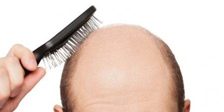 Hair Today Gone Tomorrow: JOE takes a look at receding hairlines and how LLLT technology could help…