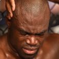 Pic: Uriah Hall wins his ninth MMA clash despite the mother of all foot injuries [Graphic content]