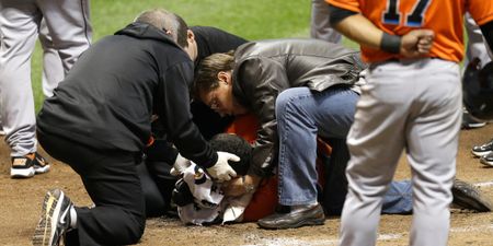 Pic: Remember that baseball player that got hit in the head on Thursday night? He’s posted pictures of his busted face (Graphic Content)