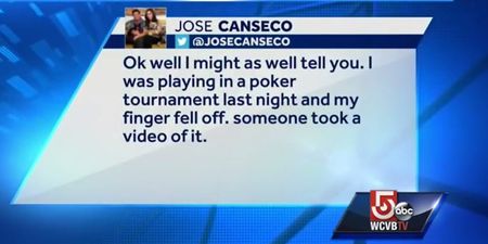 Former MLB star Jose Canseco’s finger falls off while playing poker