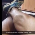 Video: Ever get a cramp in your calf? Did it look as visibly disgusting as this?