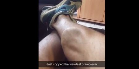 Video: Ever get a cramp in your calf? Did it look as visibly disgusting as this?
