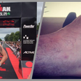 This is how Bressie went from dislocating his ankle to completing Ironman Dublin in just 8 weeks