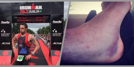 This is how Bressie went from dislocating his ankle to completing Ironman Dublin in just 8 weeks