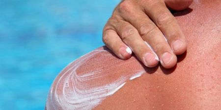 PICS: These cases of sunburn are so bad that you can almost feel the pain