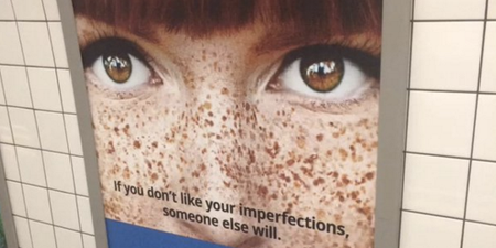 PICS: A lot of people are angry at what this dating website rates as “imperfections”