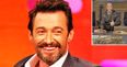 Hugh Jackman’s fans express concern about his health after latest Instagram pics