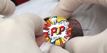 WATCH: Dr Pimple Popper’s latest spot popping video could be her worst one yet (Graphic)