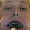 Teenager gets hammer stuck in her mouth for reasons beyond our comprehension