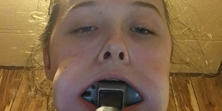 Teenager gets hammer stuck in her mouth for reasons beyond our comprehension
