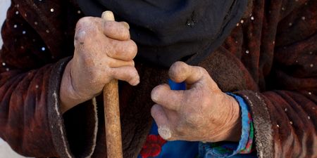 Bacteria that causes leprosy is mutating into something even more dangerous