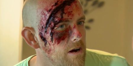 WATCH: “Holy f**k!” There is a very gory twist on the latest Irish episode of Don’t Tell The Bride