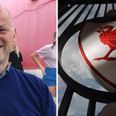 Medics aiming to bring Sean Cox out of induced coma on Monday