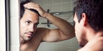 5 things to think about before getting a hair transplant
