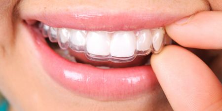 COMPETITION: Win invisible aligner dental treatment worth up to €1,799