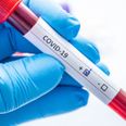 16,428 new cases of Covid-19 confirmed across Ireland