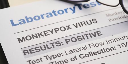 HSE team outlines potential symptoms of Monkeypox virus
