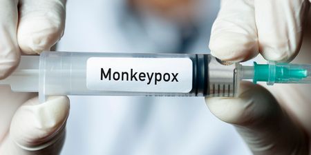 First case of Monkeypox identified in Northern Ireland