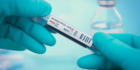Second confirmed case of monkeypox identified in Ireland