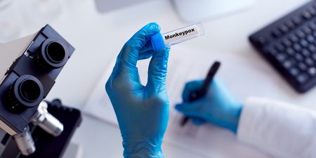 Six confirmed cases of monkeypox have been identified in Ireland