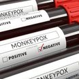 Monkeypox declared global health emergency by World Health Organisation