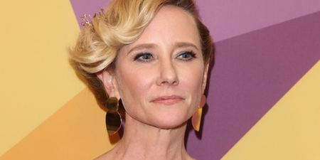 Actress Anne Heche “not expected” to survive coma following car crash