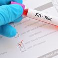 HSE announces launch of free home testing service for STIs